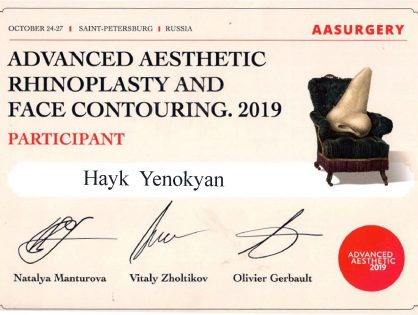 Sankt-Peterburg 2019 Rhinoplasty
